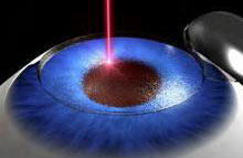 File:Eye.jpg