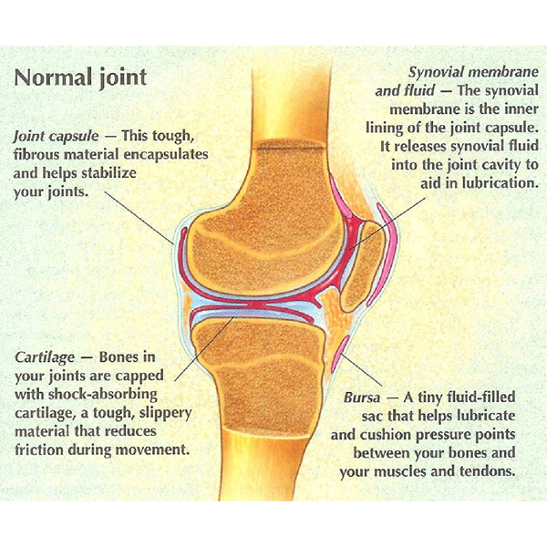 File:Best Arthritis Treatment.jpg